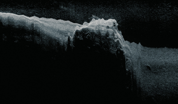 "Le cercle vide" de Stéphanie Roland